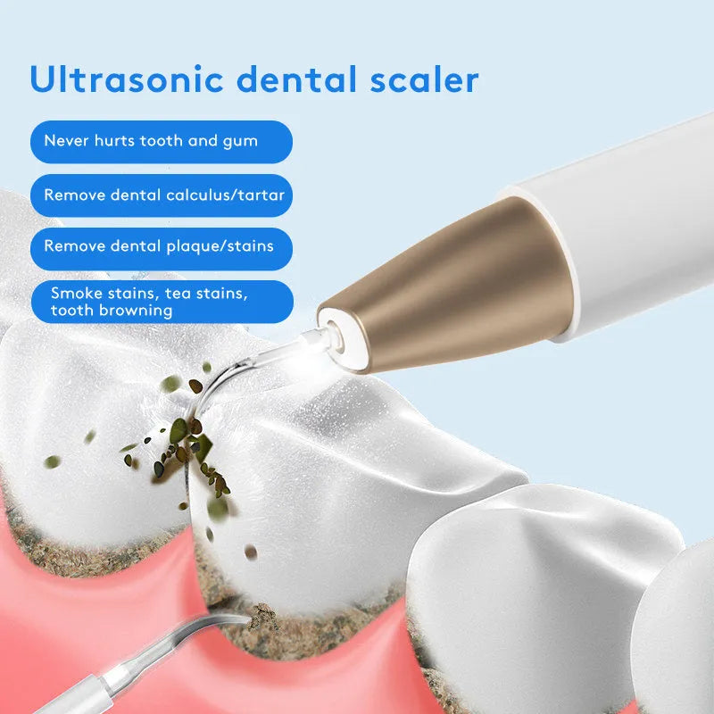 Gold handheld ultrasonic tooth cleaner for removing tartar and surface stains.
