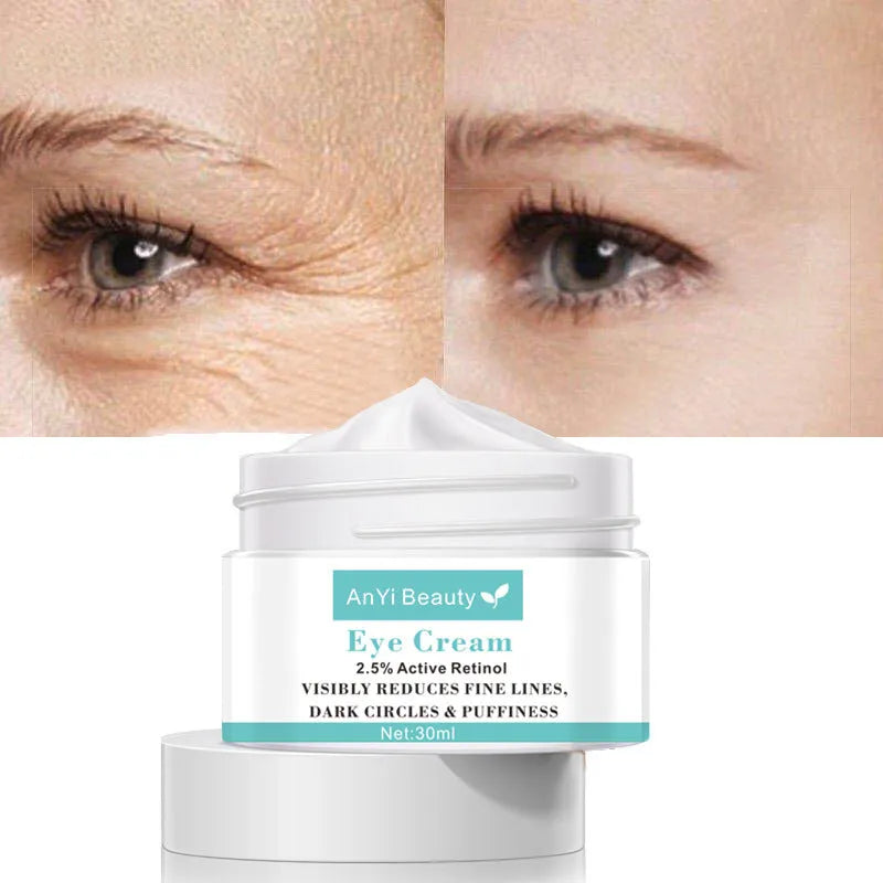 30ml beauty eye cream for women targeting dark circles, puffiness and fine lines