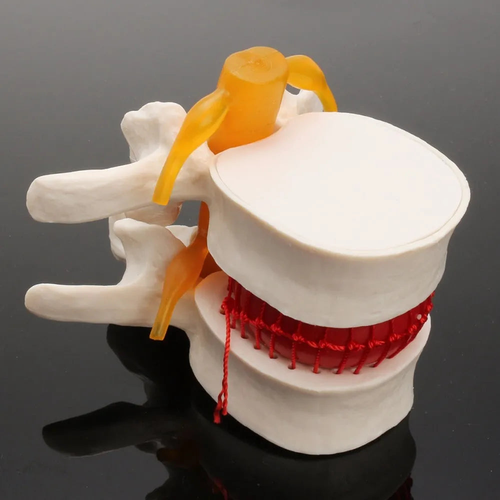 White PVC anatomical model of human lumbar intervertebral disc for medical education