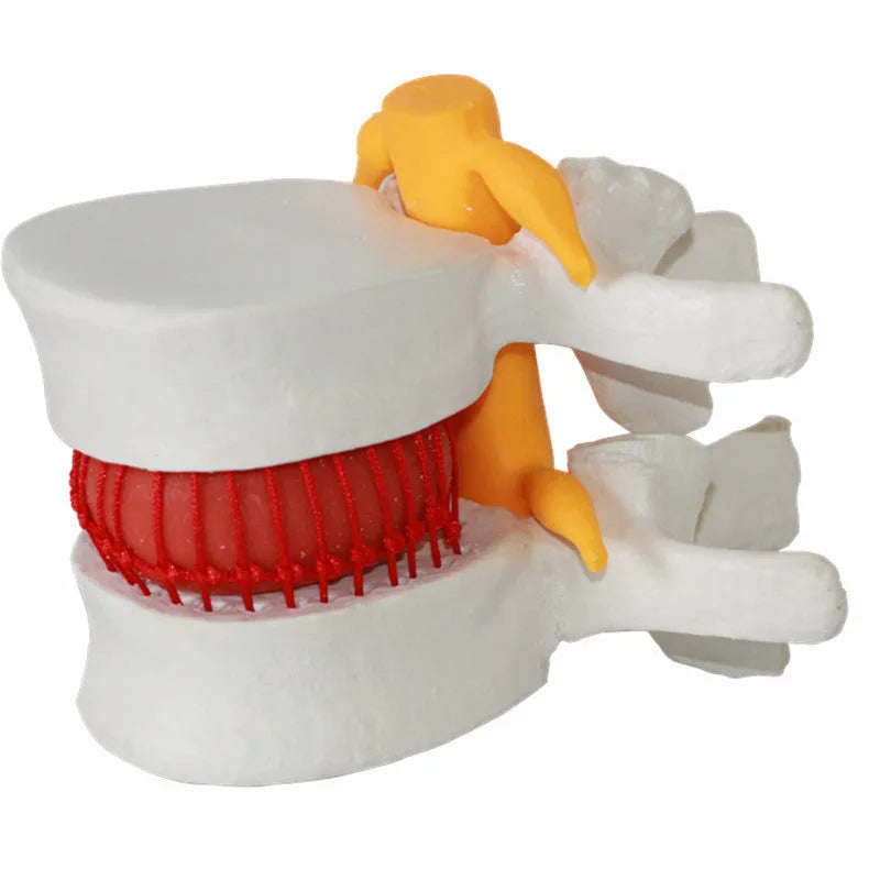 White PVC anatomical model of human lumbar intervertebral disc for medical education
