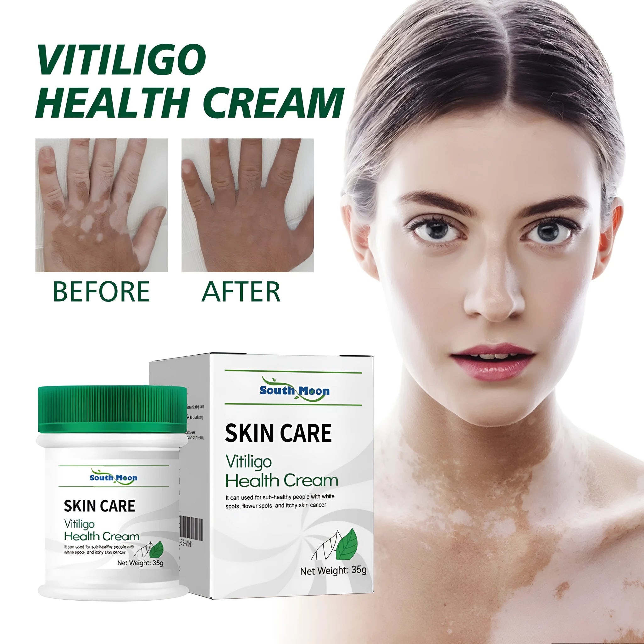 35g tube of body care cream for orange peel tissue treatment and skin moisturising