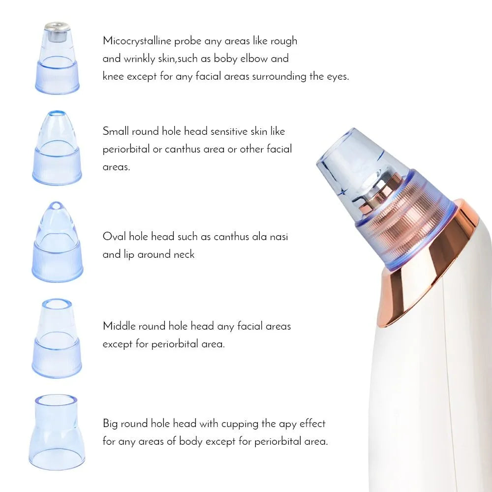 Electric blackhead remover device with multiple nozzle tips for facial pore cleaning
