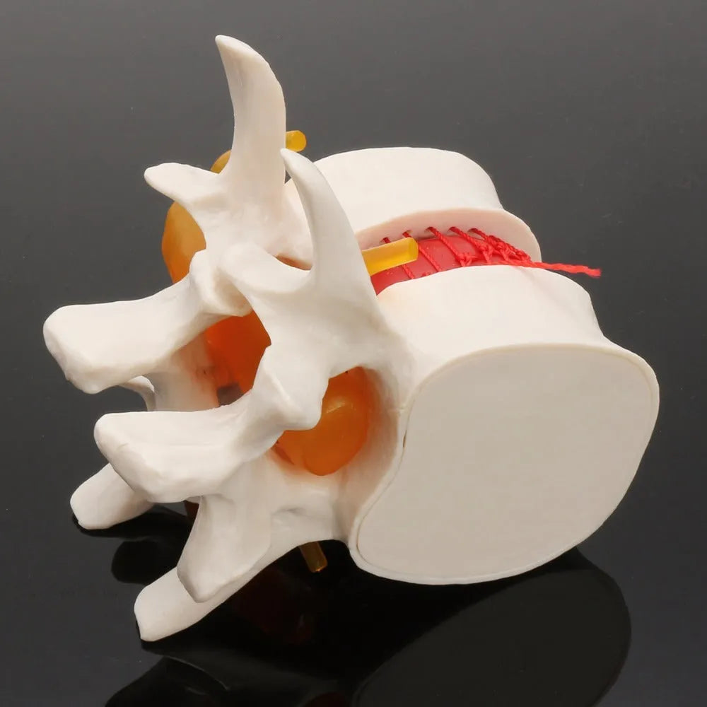 White PVC anatomical model of human lumbar intervertebral disc for medical education