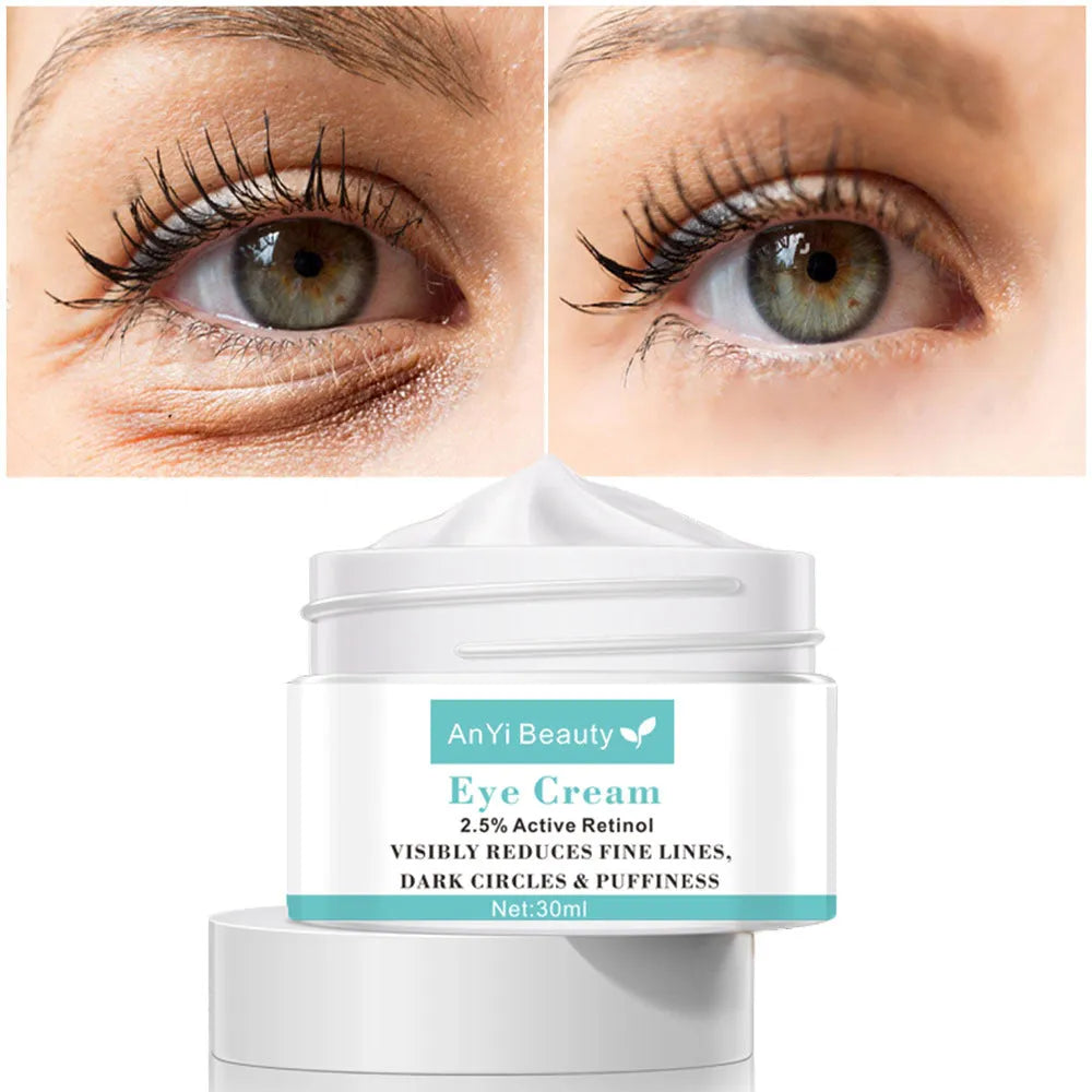 30ml beauty eye cream for women targeting dark circles, puffiness and fine lines