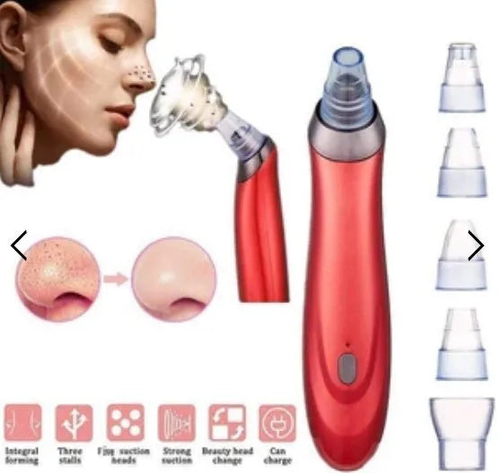 Electric blackhead remover device with multiple nozzle tips for facial pore cleaning