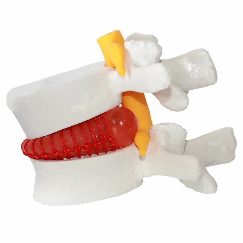 White PVC anatomical model of human lumbar intervertebral disc for medical education