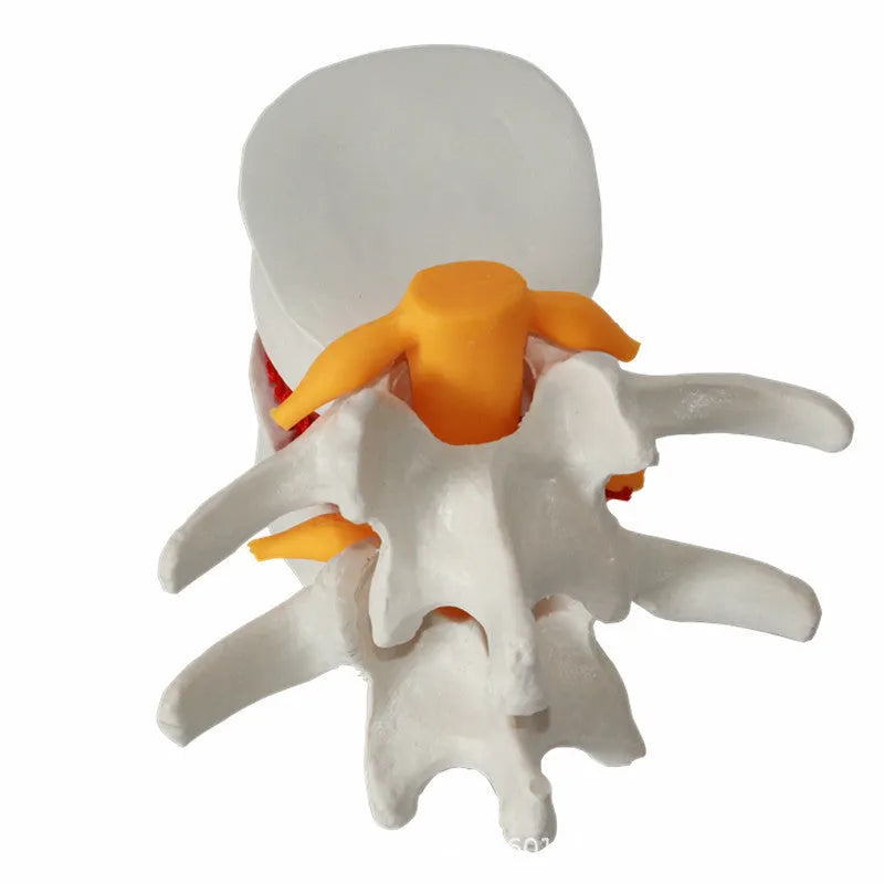 White PVC anatomical model of human lumbar intervertebral disc for medical education