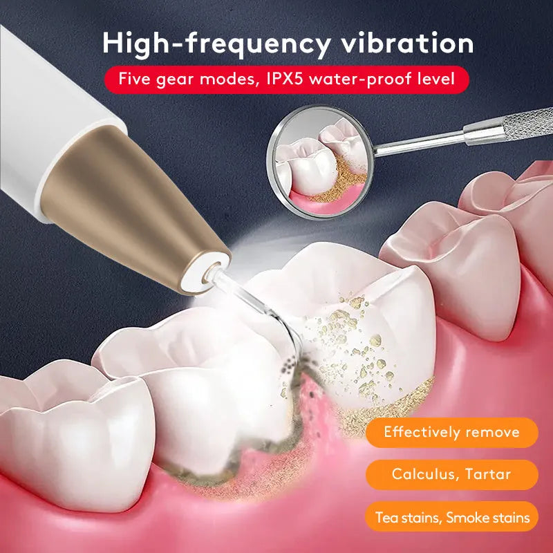 Gold handheld ultrasonic tooth cleaner for removing tartar and surface stains.