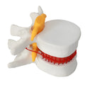 White PVC anatomical model of human lumbar intervertebral disc for medical education