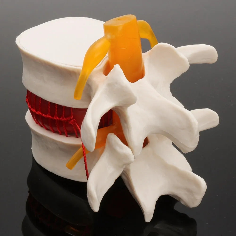 White PVC anatomical model of human lumbar intervertebral disc for medical education
