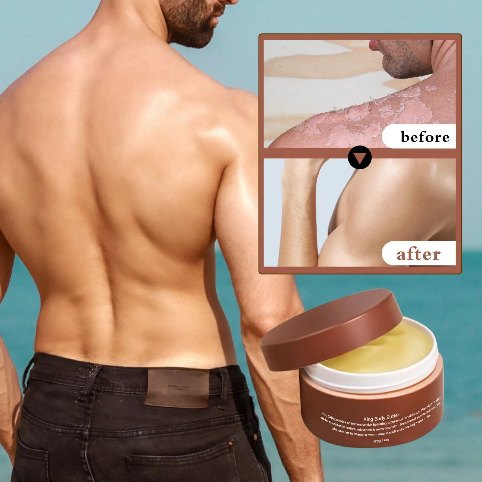 Gulong Body Moisturizer cream jar, 120g net content, for dry skin relief.