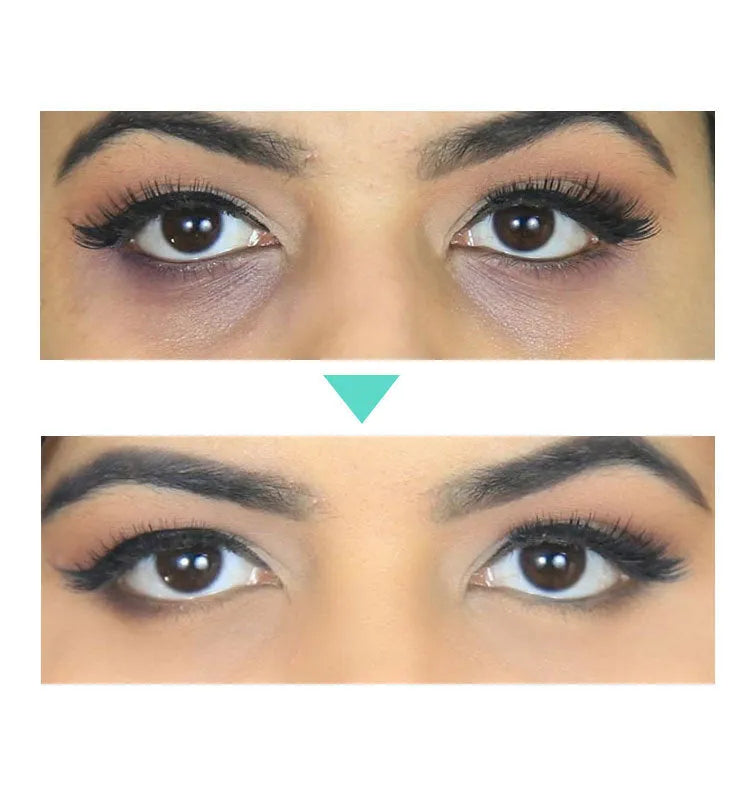 30ml beauty eye cream for women targeting dark circles, puffiness and fine lines