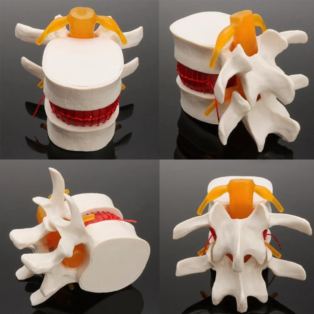 White PVC anatomical model of human lumbar intervertebral disc for medical education