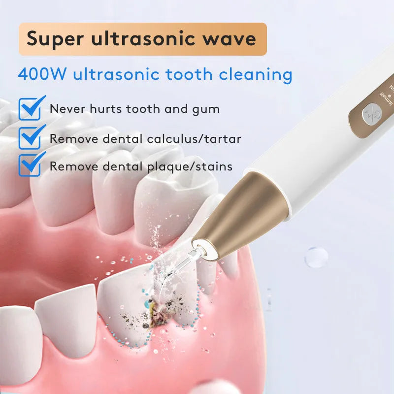 Gold handheld ultrasonic tooth cleaner for removing tartar and surface stains.
