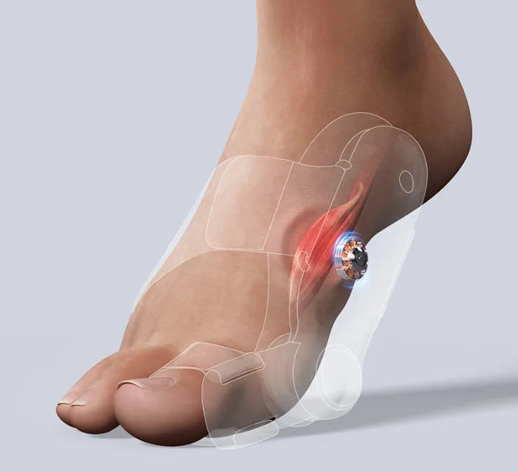 White plastic electric hallux valgus toe separator with soft silicone padding and a Type-C charging port.