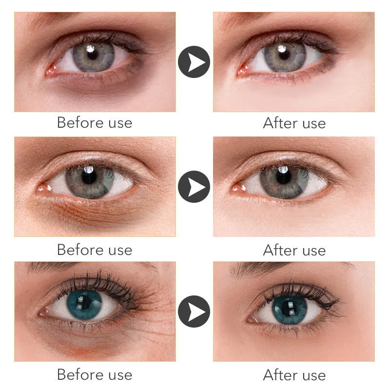 30ml beauty eye cream for women targeting dark circles, puffiness and fine lines