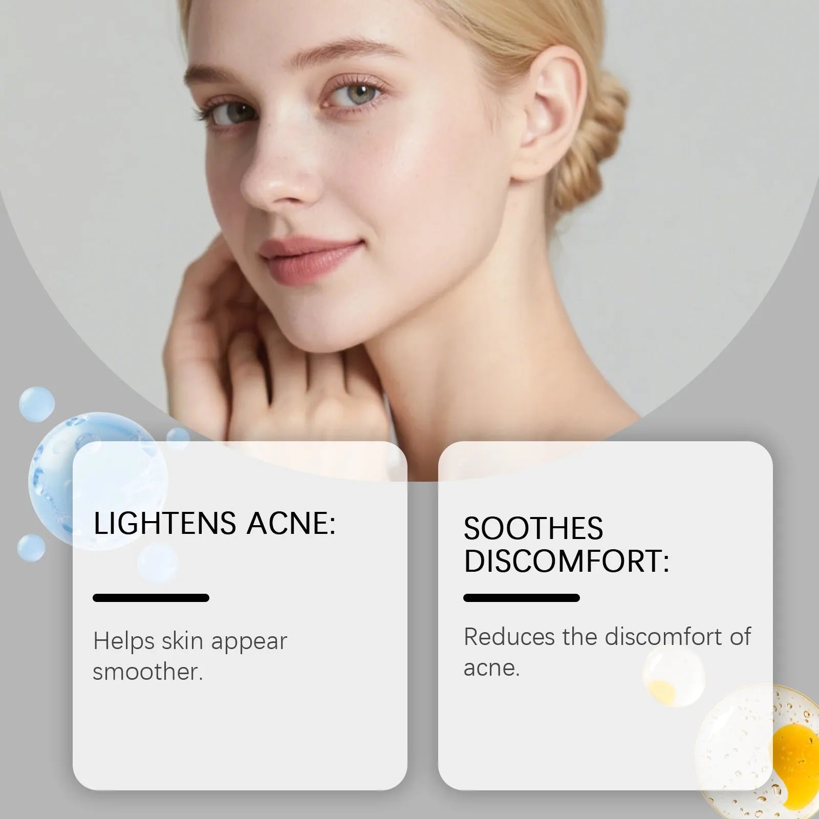 Pack of 80 hydrocolloid acne patches for spot treatment and pimple care