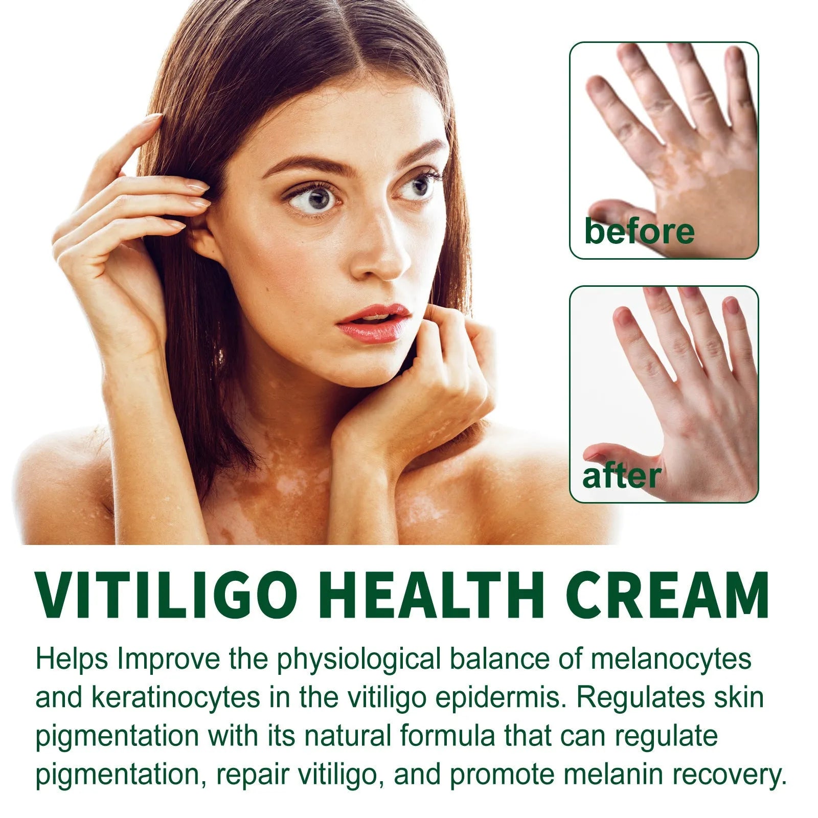 35g tube of body care cream for orange peel tissue treatment and skin moisturising