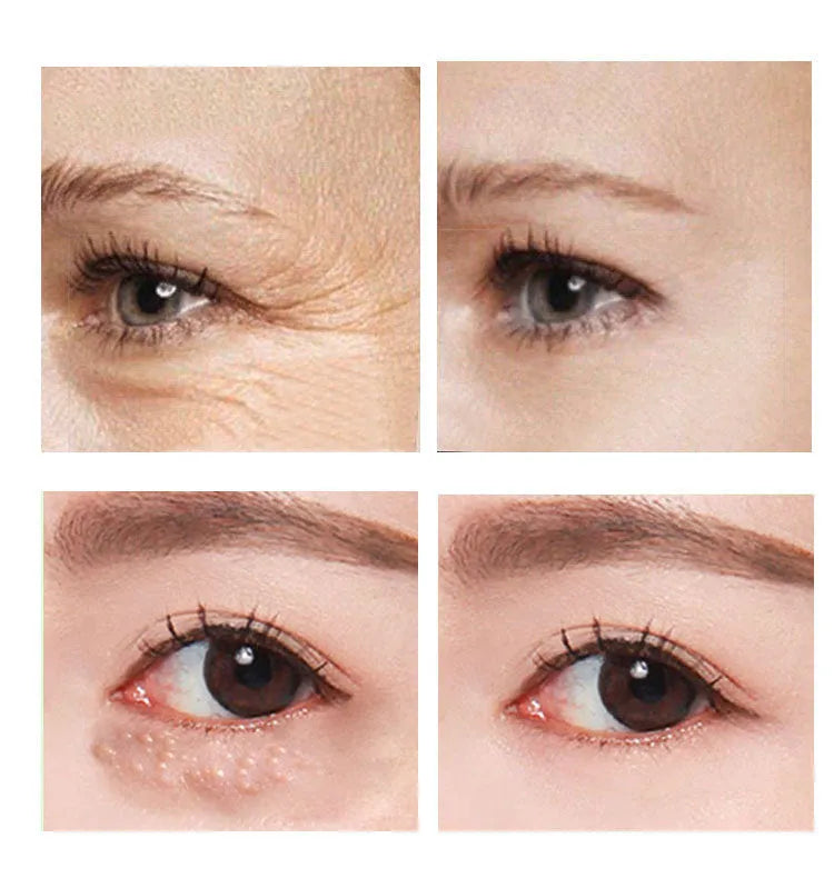 30ml beauty eye cream for women targeting dark circles, puffiness and fine lines