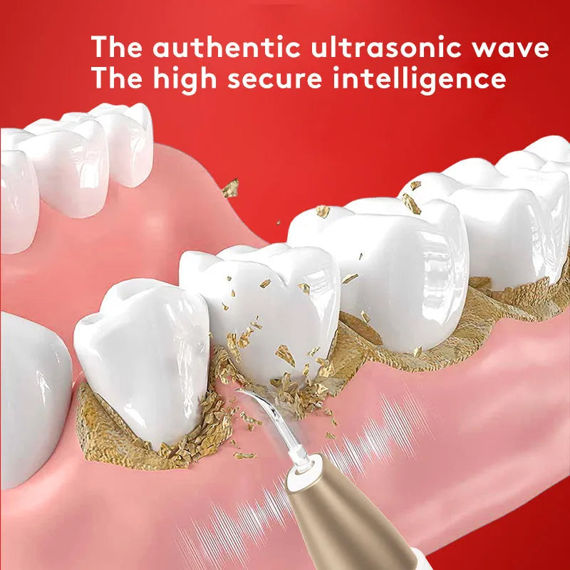 Gold handheld ultrasonic tooth cleaner for removing tartar and surface stains.